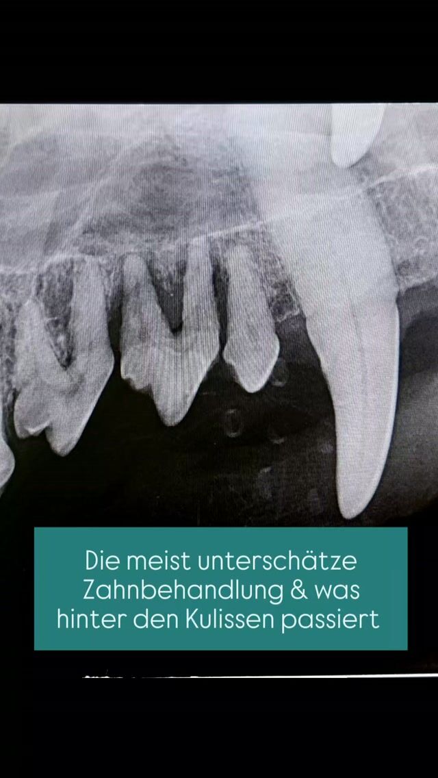Die meist unterschätzte Zahnbehandlung 🦷🐾 – was hinter den Kulissen passiert 

Warum kostet eine Zahnsanierung eigentlich so viel? Wir zeigen euch, wie viel Sorgfalt und Aufwand dahintersteckt. 

Vor der Narkose ❤️
Wir untersuchen euer Tier gründlich und empfehlen eine Blutuntersuchung, um die Organfunktionen zu überprüfen und die Narkose bestmöglich anzupassen. 

Während der Narkose 🩺
Euer Tier wird durchgehend von einer unserer Anästhesieschwestern überwacht. Dabei kontrollieren wir unter anderem Herzfunktion, Blutdruck, Puls, Sauerstoffsättigung und Körpertemperatur, um bei Auffälligkeiten sofort reagieren zu können. 

Die eigentliche Zahnbehandlung 🦷
Zunächst röntgen wir alle vier Kieferquadranten, da nicht jedes Zahnproblem von außen sichtbar ist. Anschließend untersuchen wir jeden Zahn sorgfältig, reinigen und polieren ihn professionell und entfernen erkrankte Zähne bei Bedarf schonend. 

⏱️ Wusstet ihr, dass eine Zahnsanierung mehrere Stunden dauern kann? Jeder Schritt braucht Zeit, Sorgfalt und höchste Konzentration. 

Ihr seht: Hinter einer Zahnbehandlung steckt sehr viel mehr, als man auf dem ersten Blick vermuten würde. 
Das Wohl eures Tieres hat für uns immer höchste Priorität. ❤️ 

Ihr habt Fragen oder euer Tier benötigt eine Zahnbehandlung? Meldet euch bei uns, wir beraten euch gern! 🐾